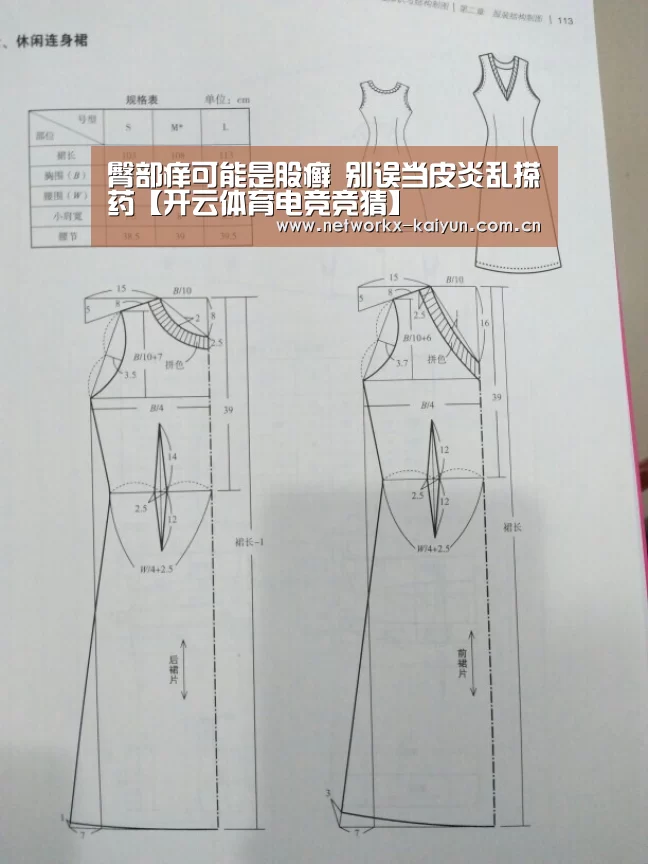 臀部痒可能是股癣 别误当皮炎乱搽药【开云体育电竞竞猜】(图2) 开元